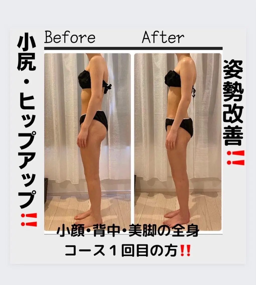 食いしばり・首肩疲れを背中姿勢から整える小顔コルギ背中60分小顔60分の写真