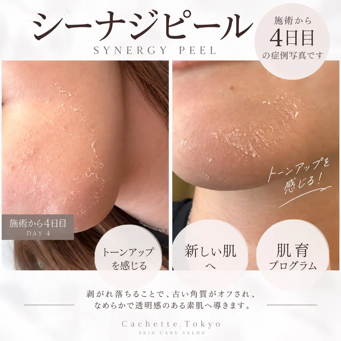 エステ カシェット トーキョーのエステ・リラクイメージ
