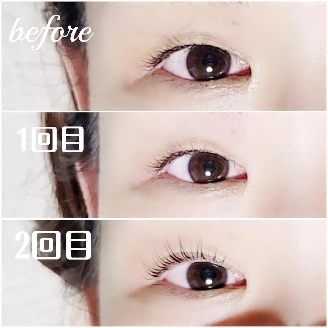ダブルアイリフト(まつパと目元の骨膜マッサージ)の写真