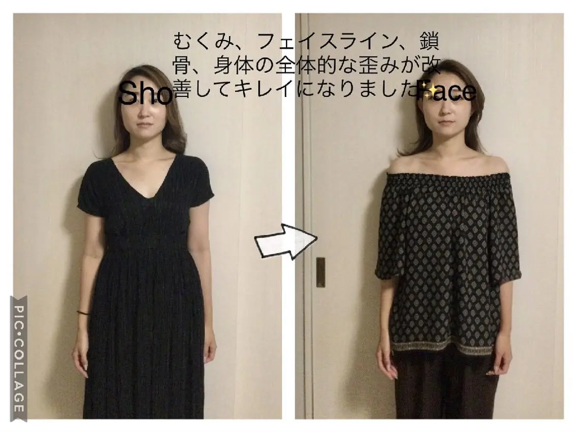 【残り3名】本気で変えたい方へ。2回集中お試し。歪み・むくみを根本リセット! ¥10,000の写真