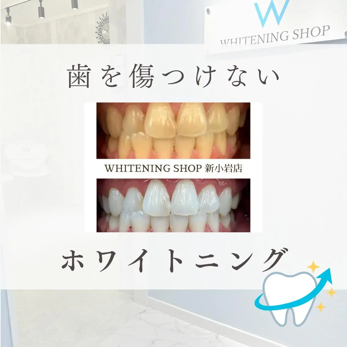 メンズ その他 ホワイトニング ショップ新小岩店のその他イメージ