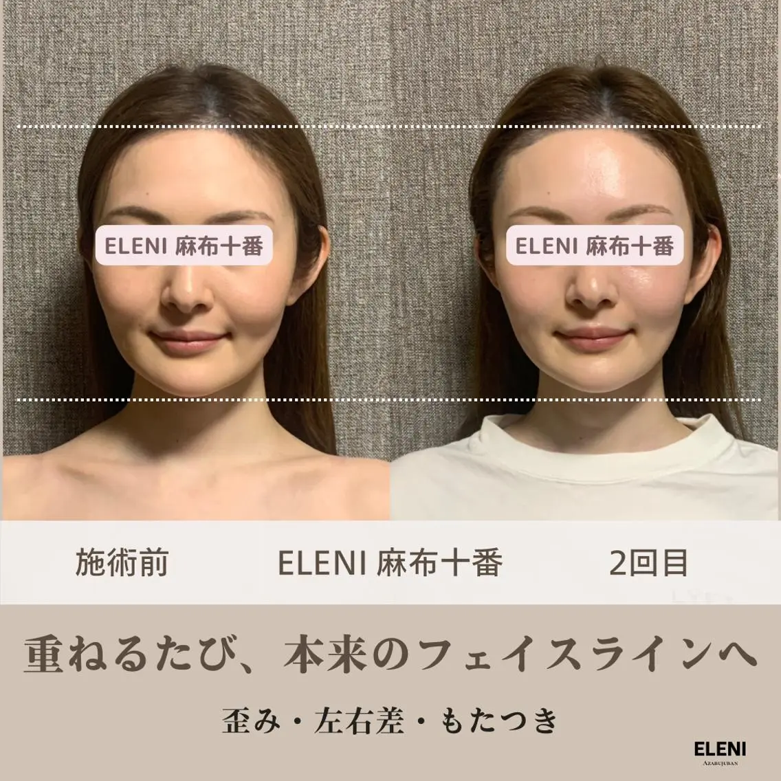 麻布十番小顔コルギ 姿勢矯正リアン💗のエステ・リラクイメージ