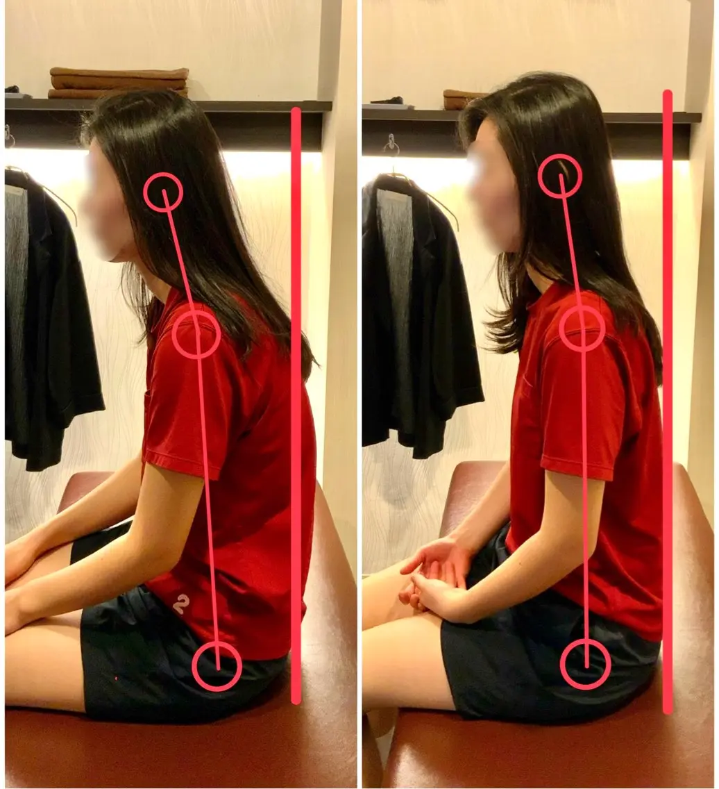 【骨盤矯正/猫背矯正】美姿勢を目指しましょう🌟身体の歪み/反り腰/腰痛/猫背/巻き肩/首、肩こり・疲れの写真