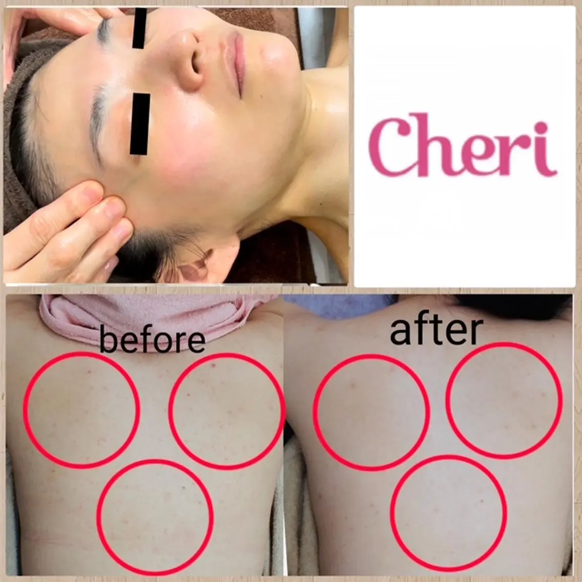 肌ケア&毛穴洗浄 Cheri/女性専用のエステ・リラクイメージ