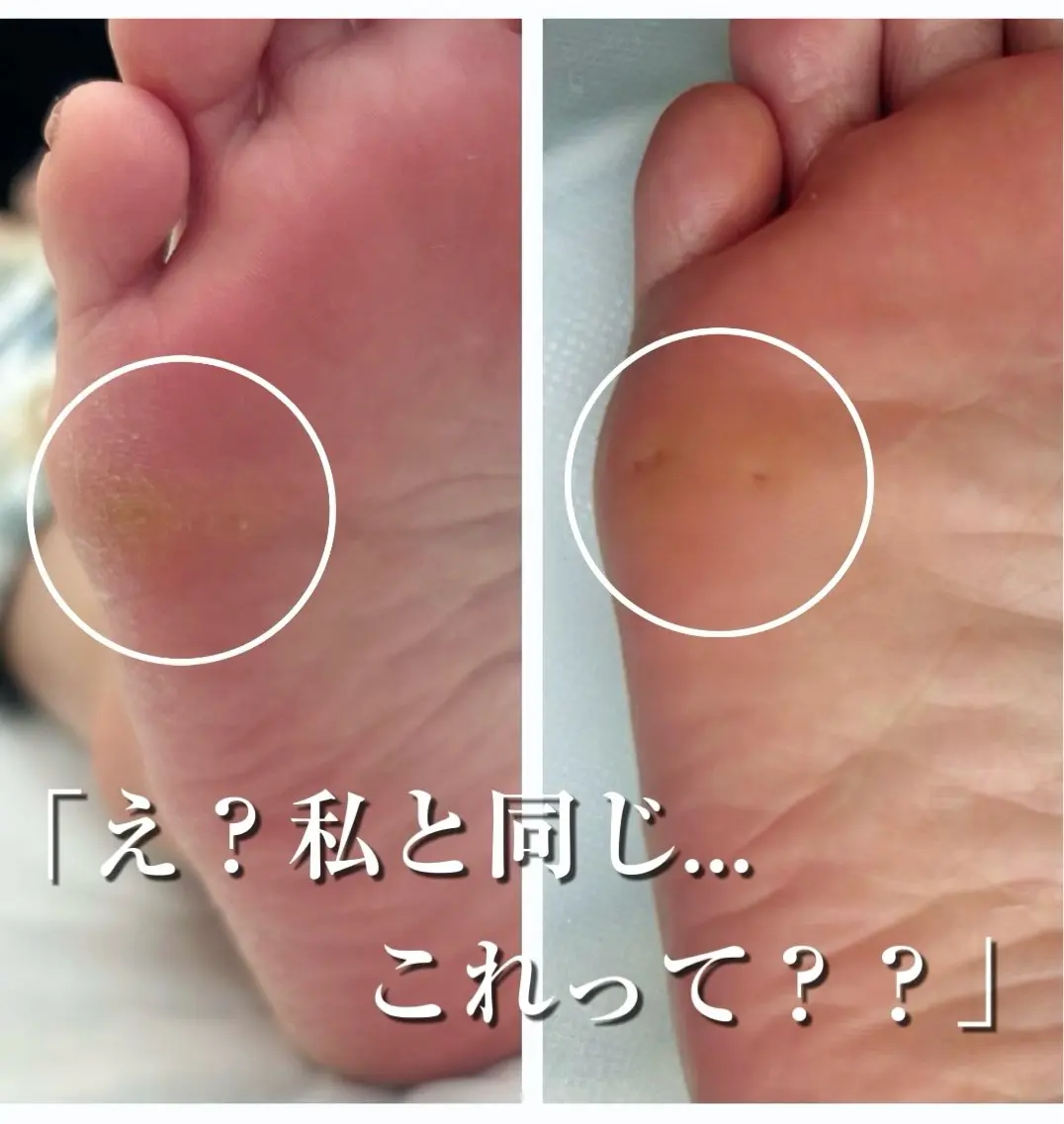 その他 フットケアサロン Kotoriのその他イメージ