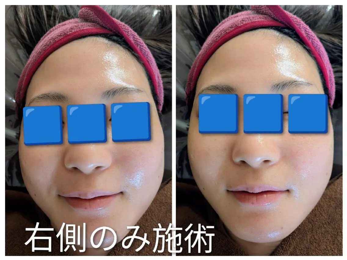 フェイシャルエステの写真
