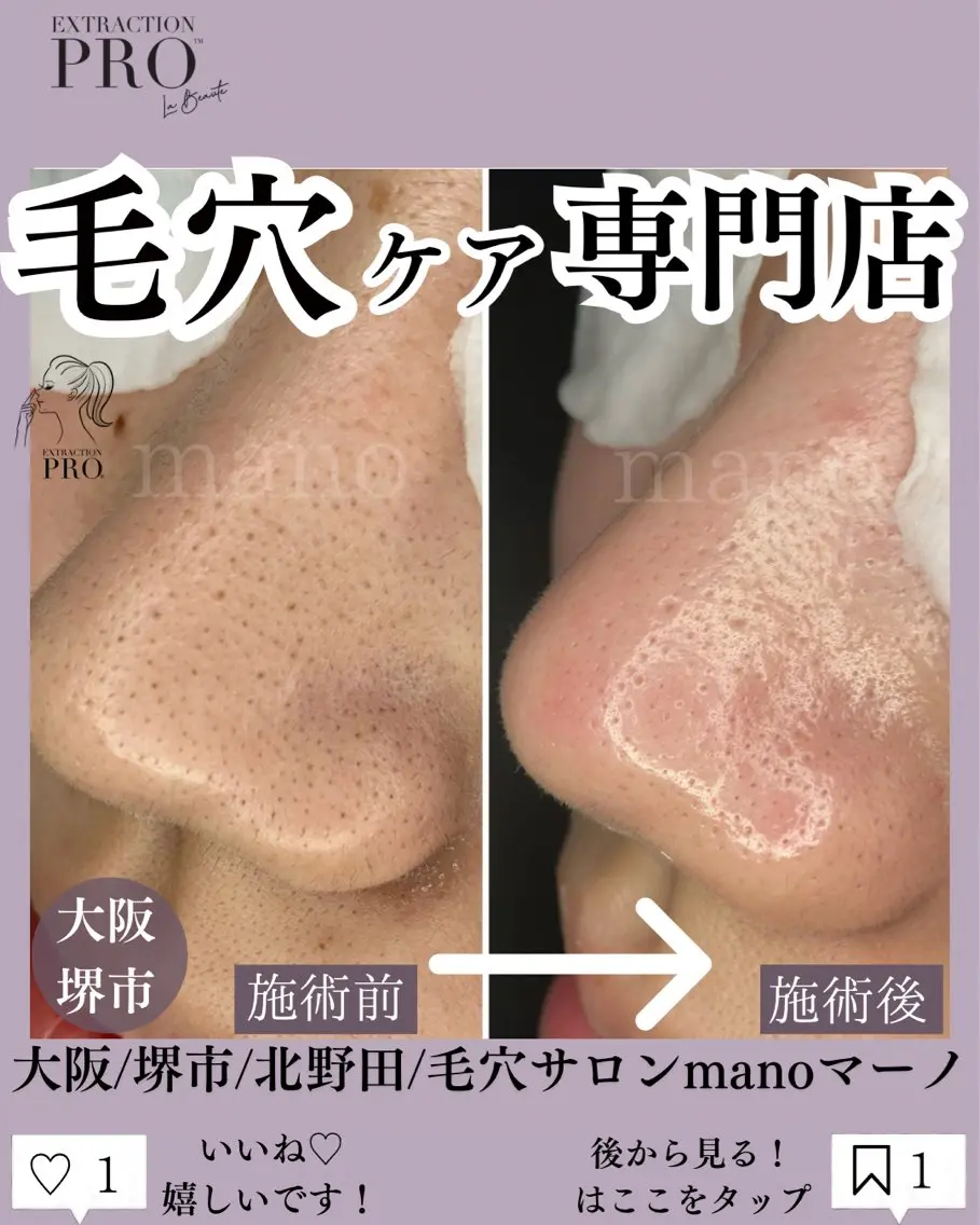 【当店1番】人気毛穴美人コースの写真