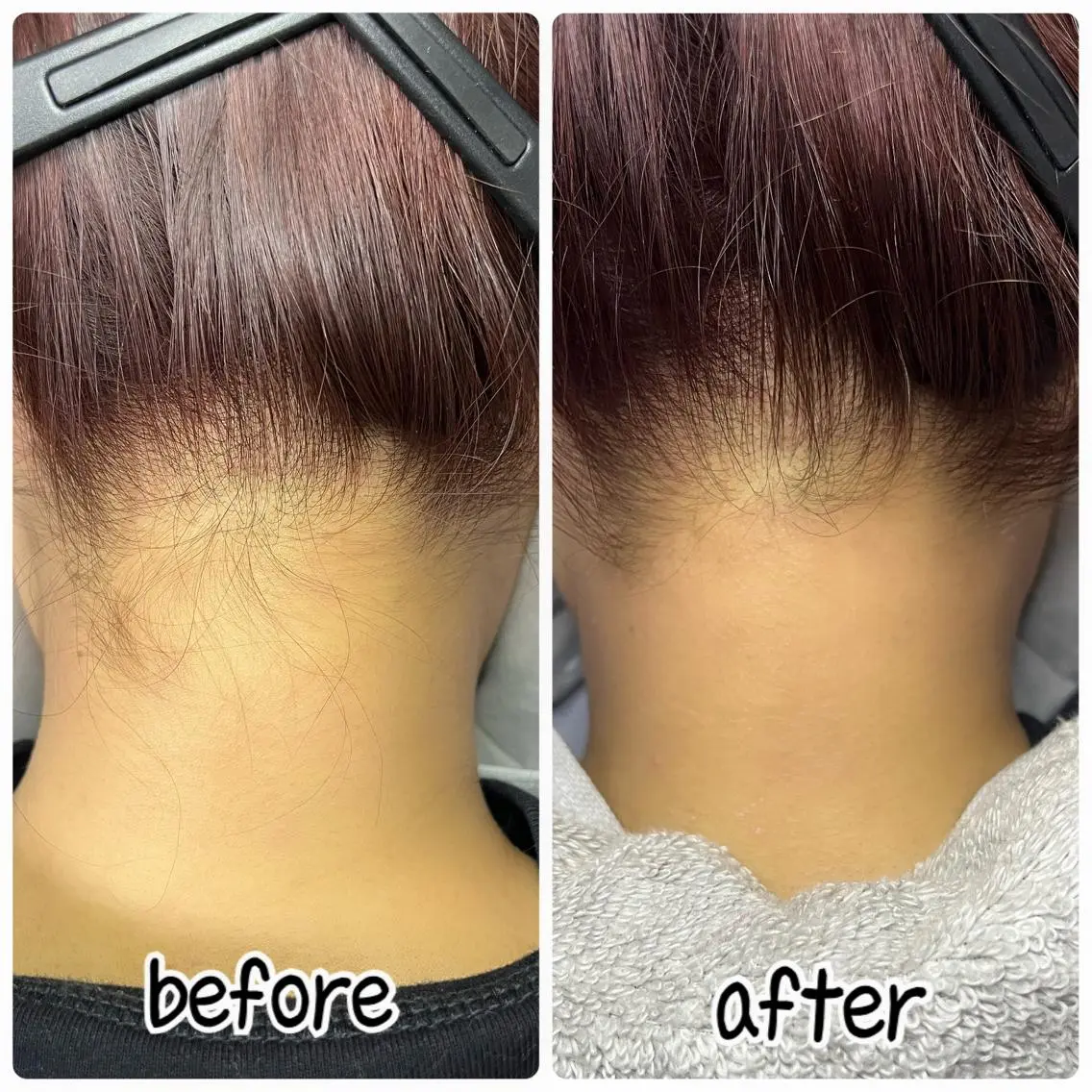 脱毛 totalsalon R.sの眉毛・アイブロウイメージ