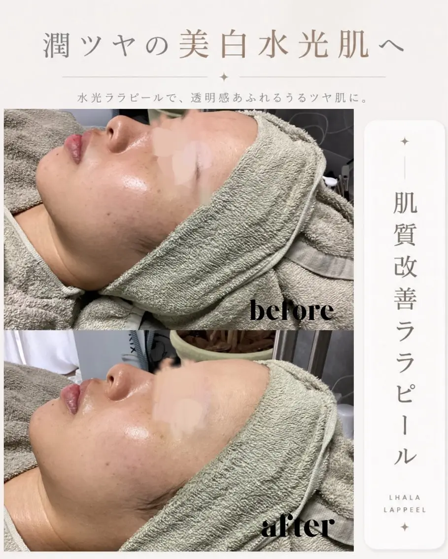 メンズ エステ 【BUB立川】 ゆかのエステ・リラクイメージ