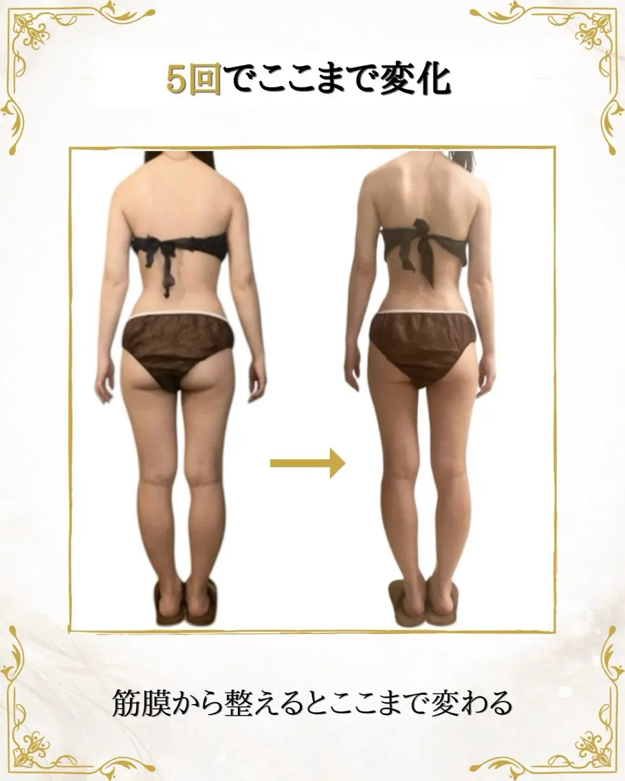 筋膜×深部温熱 リラク★痩身RIONのエステ・リラクイメージ