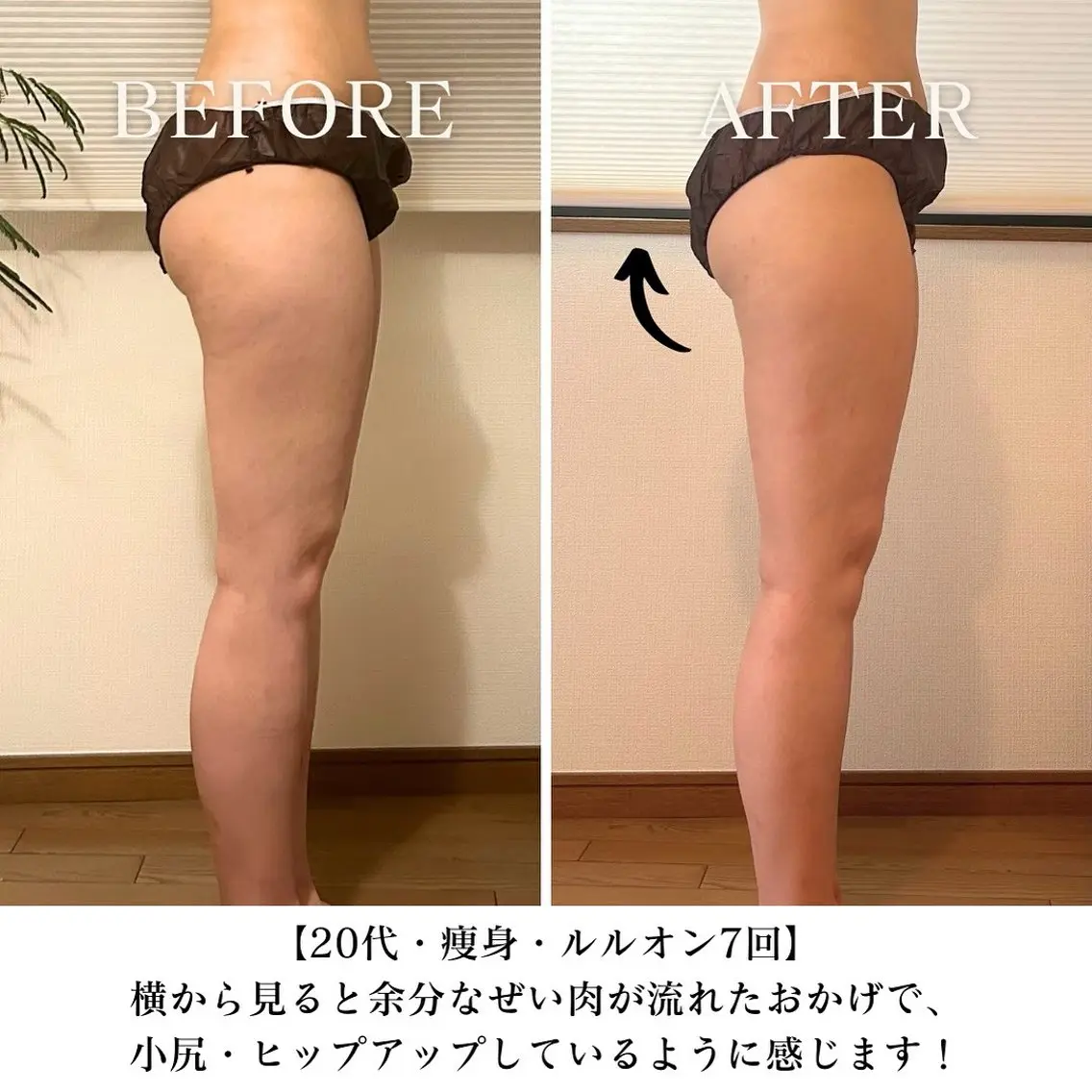 【三軒茶屋/下馬】 本格痩身・よもぎ蒸しのエステ・リラクイメージ
