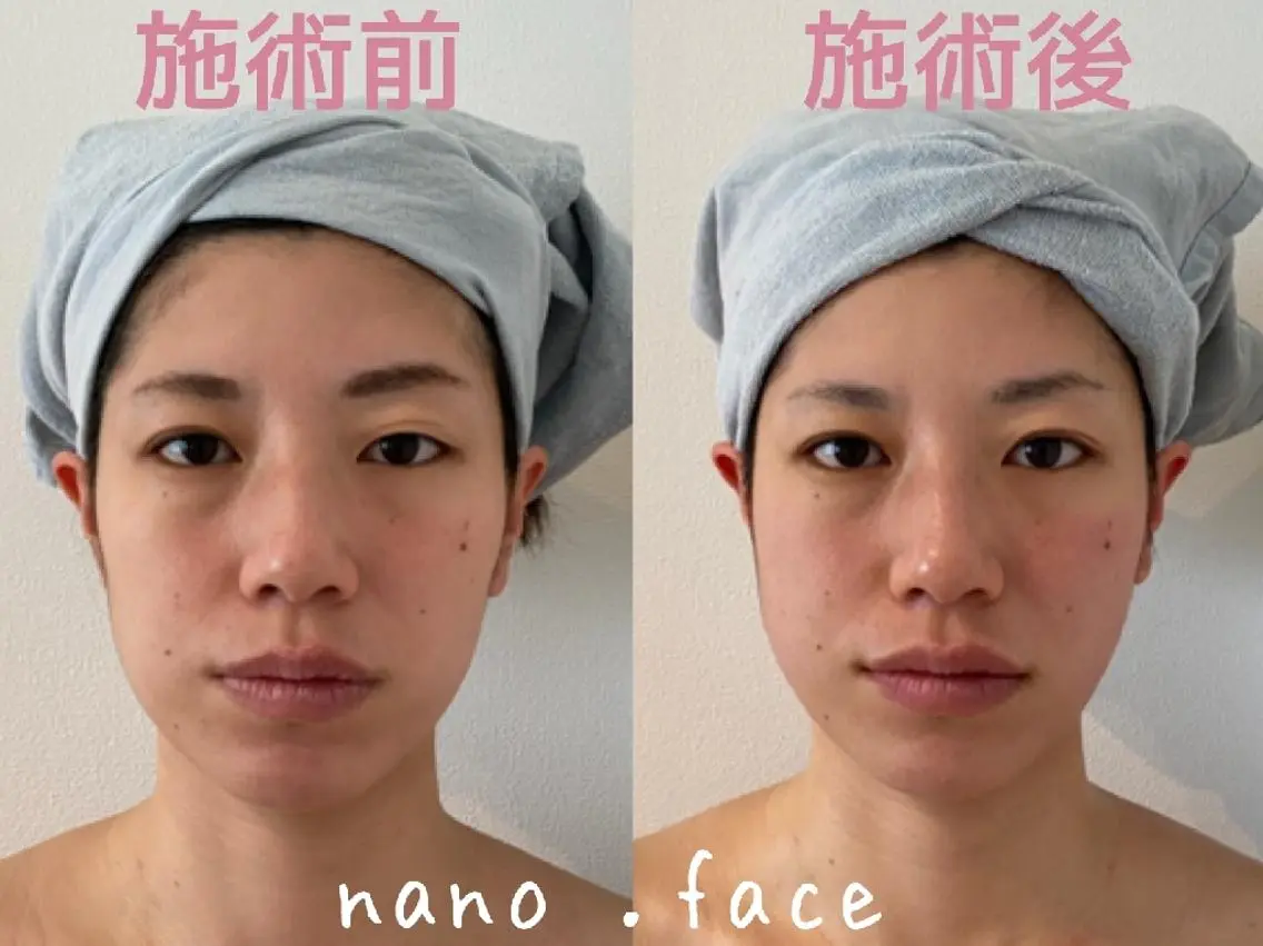 マツエク・マツパ 美容鍼/小顔&整体 nano.faceのエステ・リラクイメージ