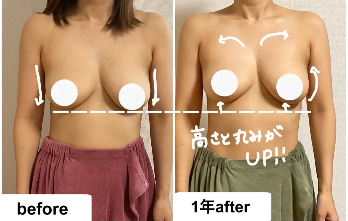【バストダウン!】大きいバストを小さくしたい方。一緒に試してみませんか?モニターとしてチャレンジしてみたい方向けですの写真