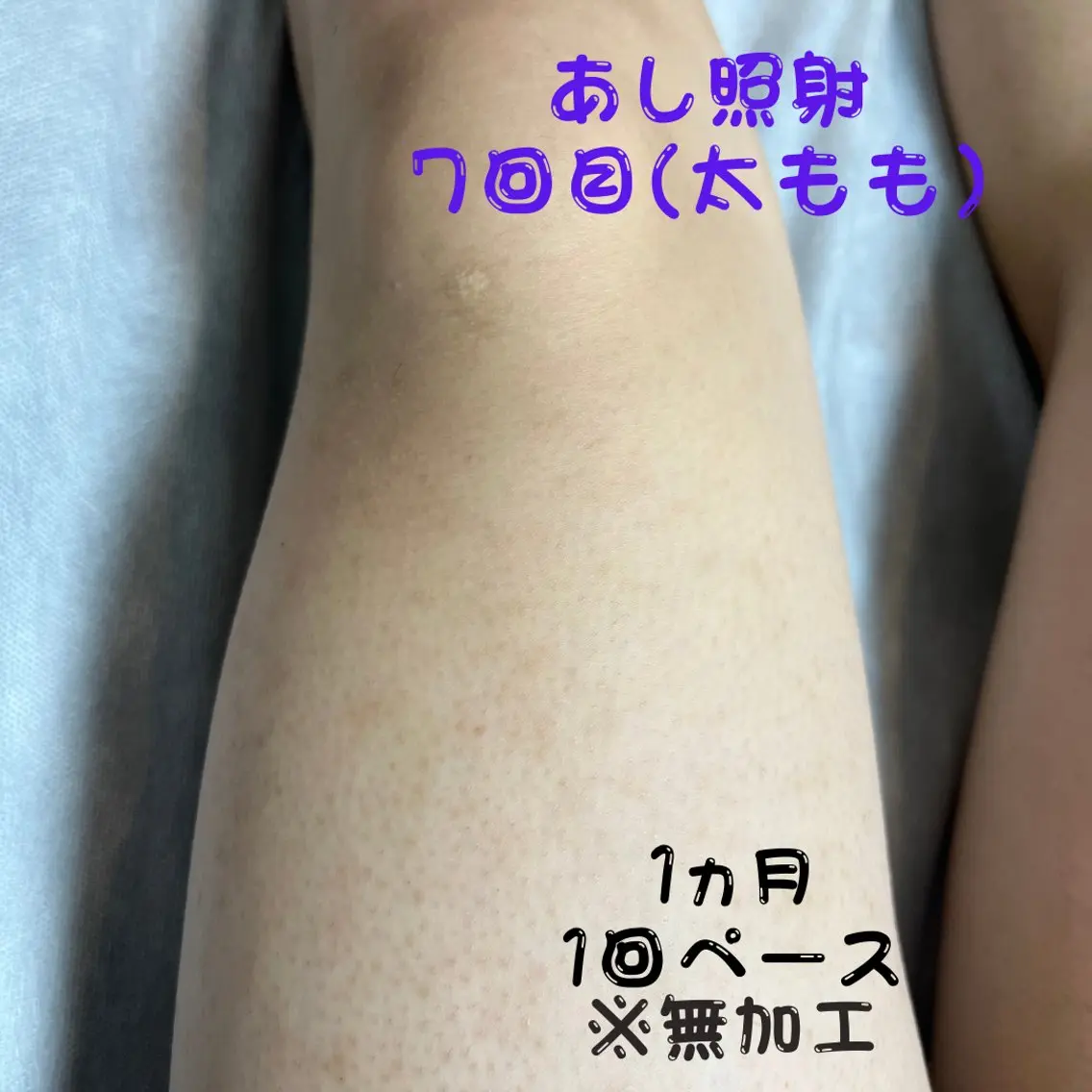 メンズ キッズ 脱毛 メンズ脱毛フェリッセ /男女🆗キッズ🆗のエステ・リラクイメージ