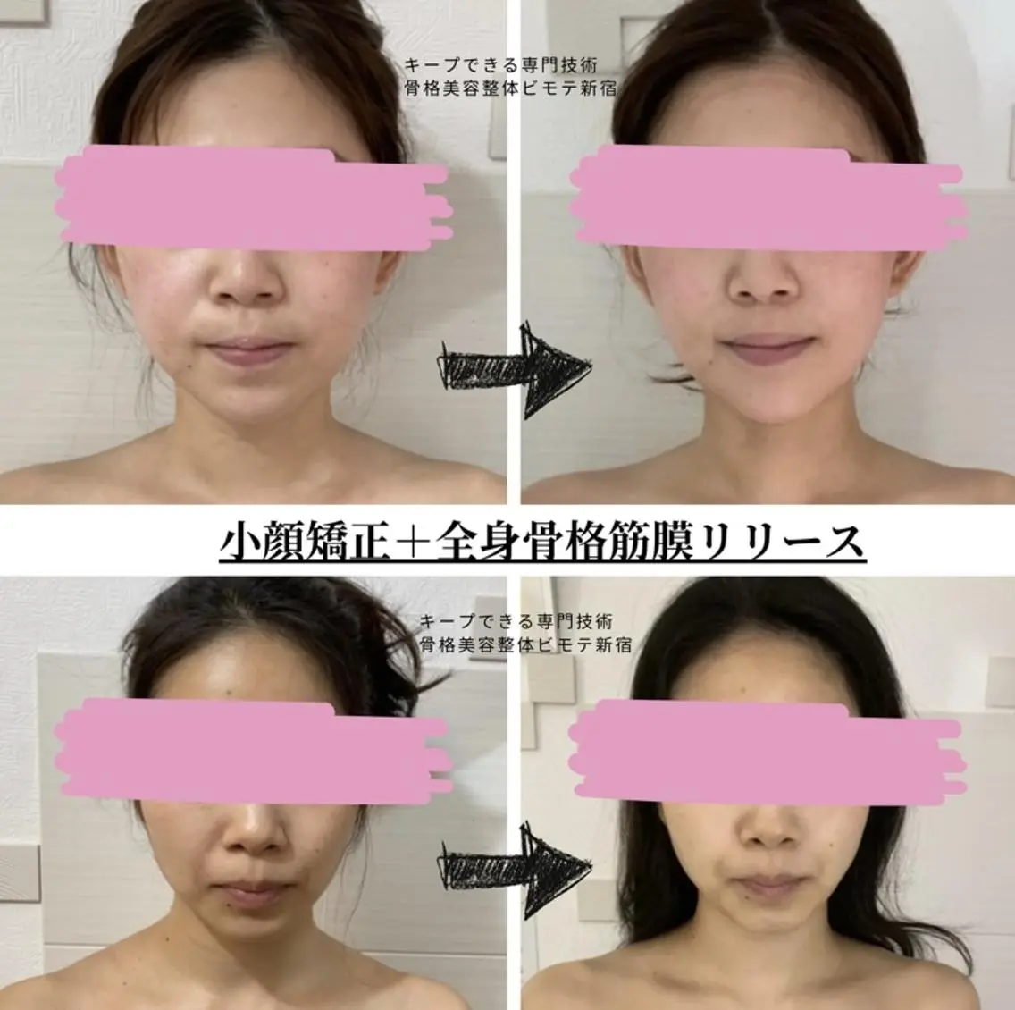 女性限定🍀【全身骨格筋膜リリース+小顔矯正】ボディトリートメント✨美顔/フェイシャルエステ/肩こり/脚瘦せ/バストケアの写真