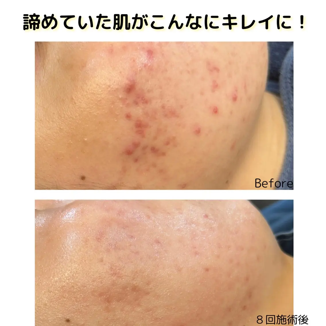 leolo武蔵浦和 肌質改善&脱毛のエステ・リラクイメージ
