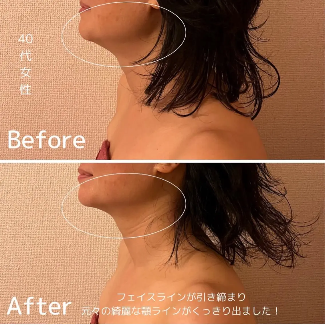 エステ リラク 表情筋フェイシャル 三軒茶屋のエステ・リラクイメージ
