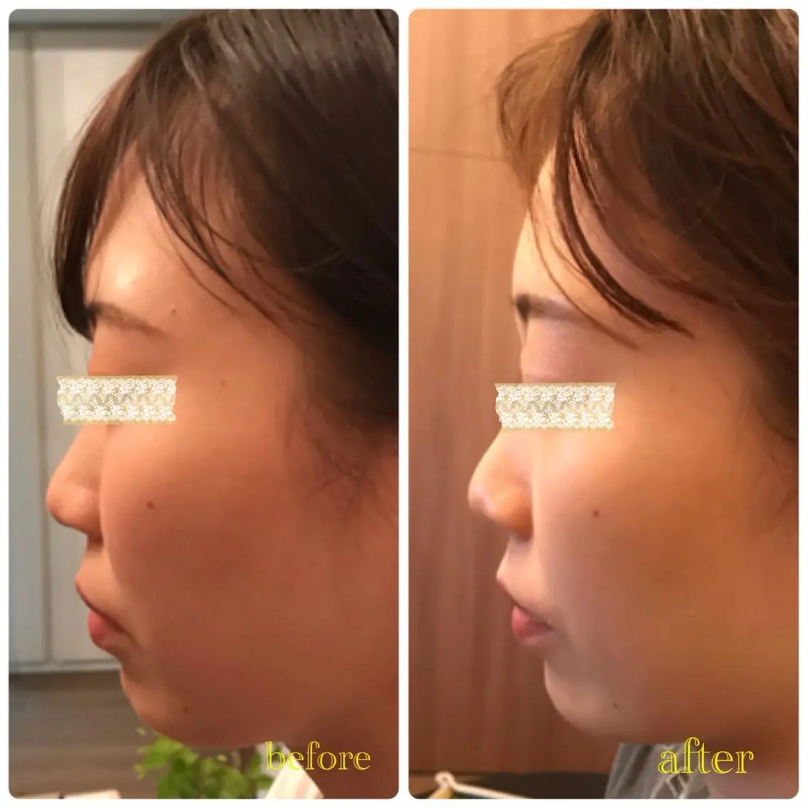 NO.1人気コース✨100%実感‼️小顔整体 施術30分✨月先着5名様💕の写真