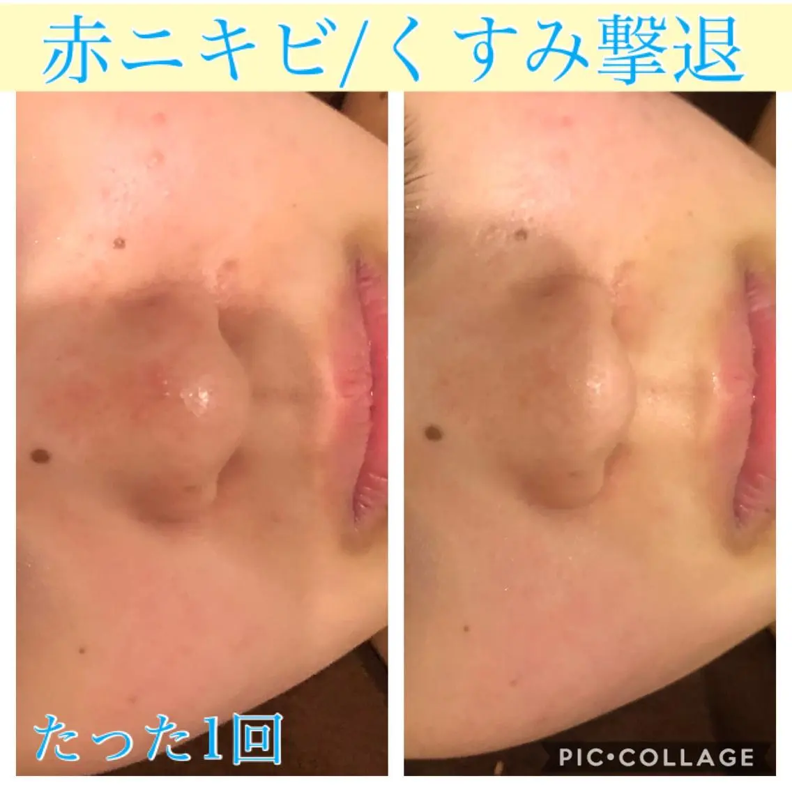 ショート カラー パーマ ヘアアレンジ キッズ ネイル マツエク・マツパ エステ リラク EnsorClair 代表　野口真央のエステ・リラクイメージ