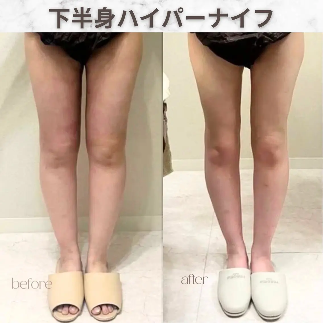aimer服部 /  小顔 ・ 痩身のその他イメージ