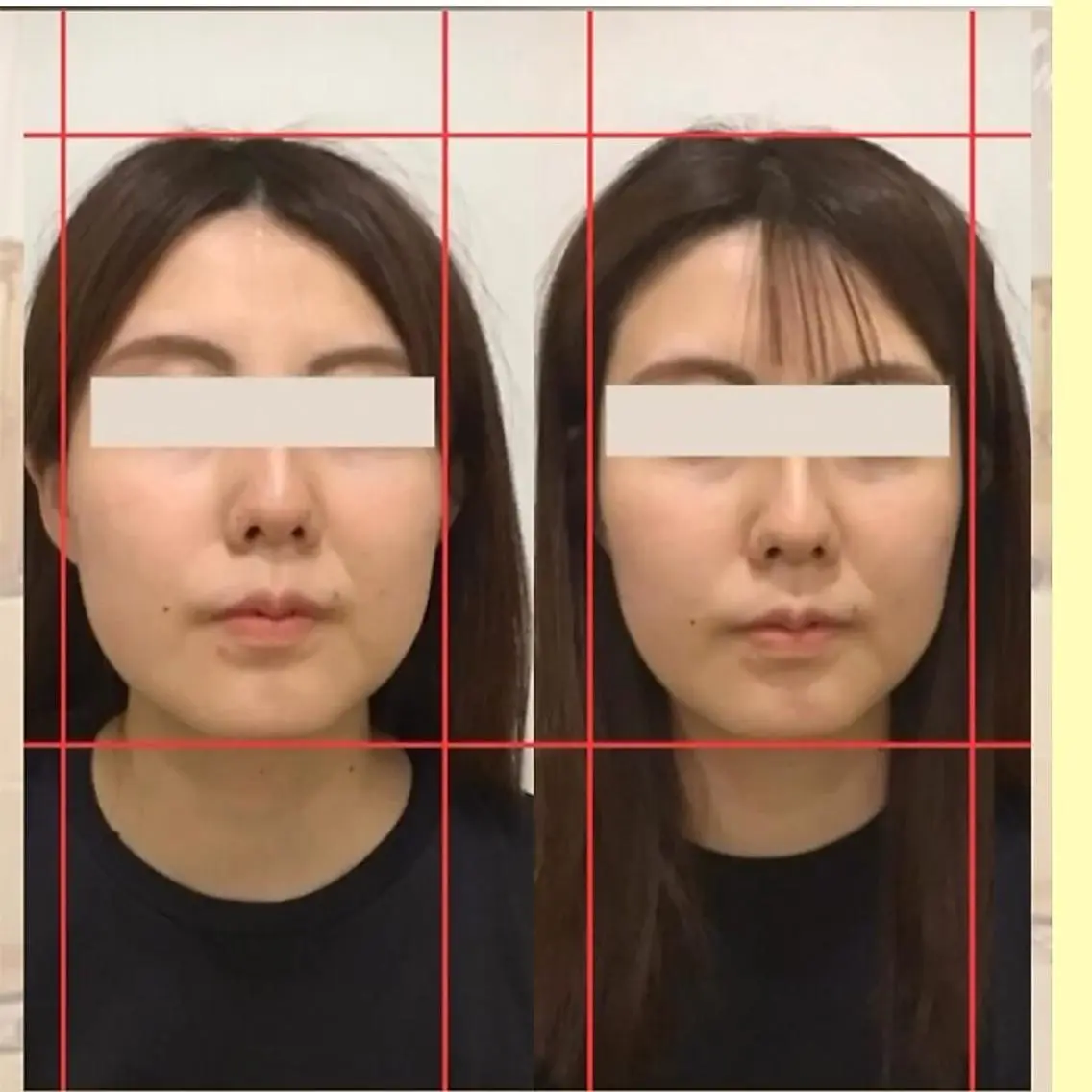 【整った輪郭へ】小顔3D整顔＆肩こり・首こりケア カウンセリング含む全体50分の写真
