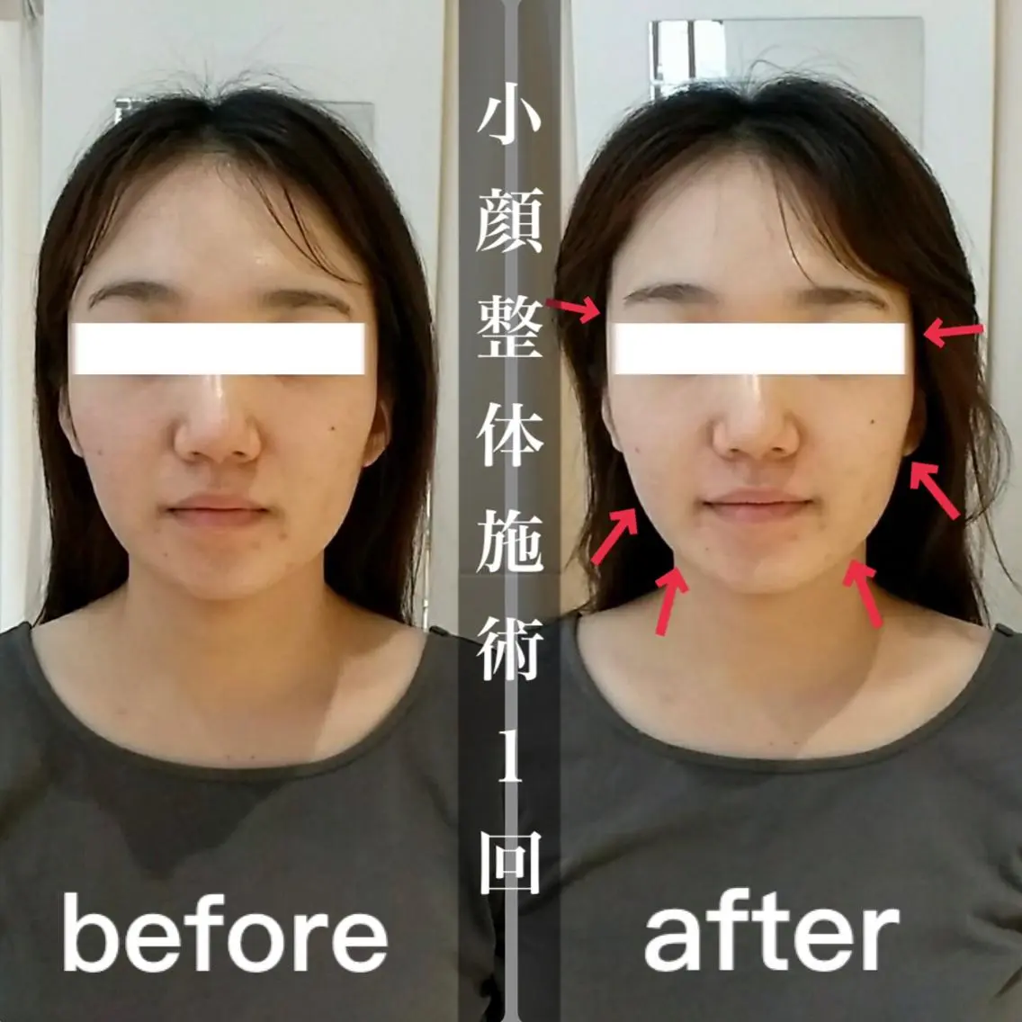 鍼灸 Refineのその他イメージ