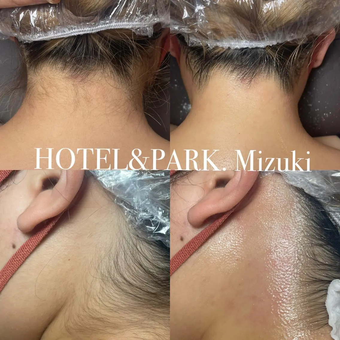 HOTEL&PARK . ワックス脱毛のエステ・リラクイメージ