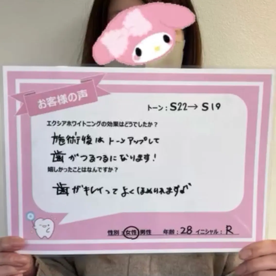 セルフホワイトニング エクシア熊本下通り店のその他イメージ