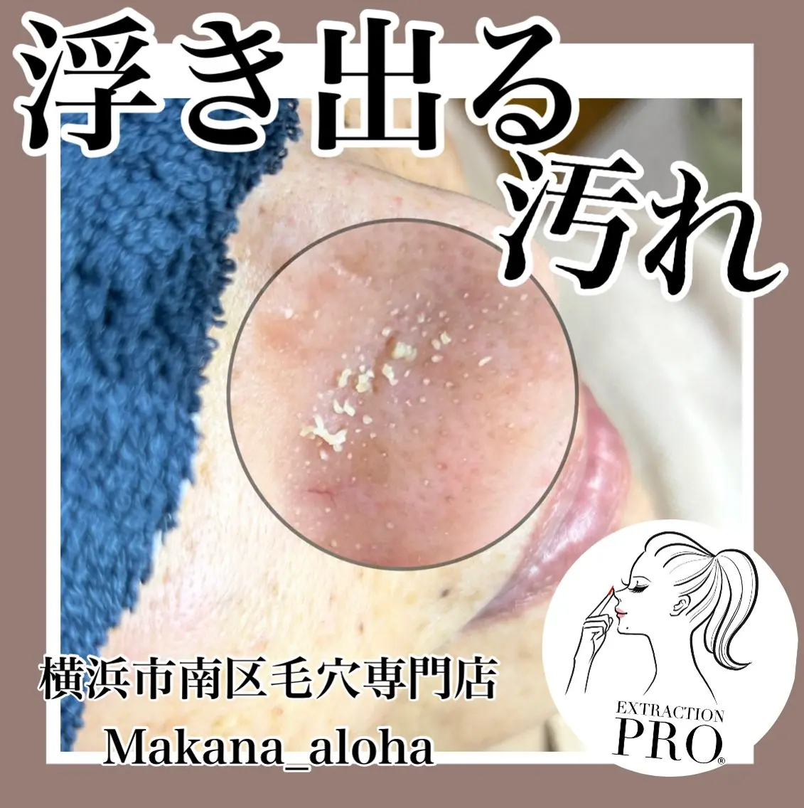 毛穴専門店 マカナアロハのエステ・リラクイメージ