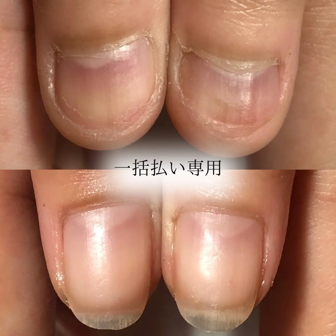【トップコートでピンクの部分を伸ばす】自爪育成コース🎁ご新規様ホームケアセットプレゼント🎁の写真