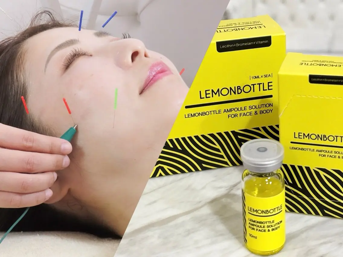 🍋美容鍼+LEMON BOTTLE🍋【当日予約🆗】すっきり小顔ケアを目指したい方に1番おすすめ!の写真
