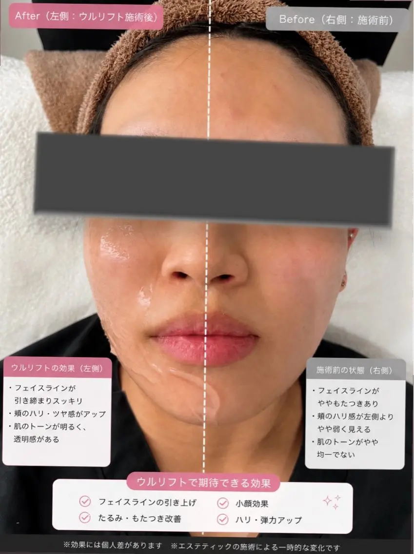 マツエク・マツパ エステ 愛維美水光美肌専門店 メンズレディースokのエステ・リラクイメージ