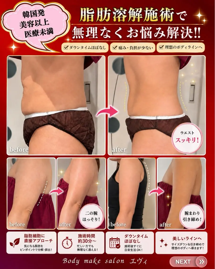 肌質改善/ボディケア サロン　エヴィのエステ・リラクイメージ