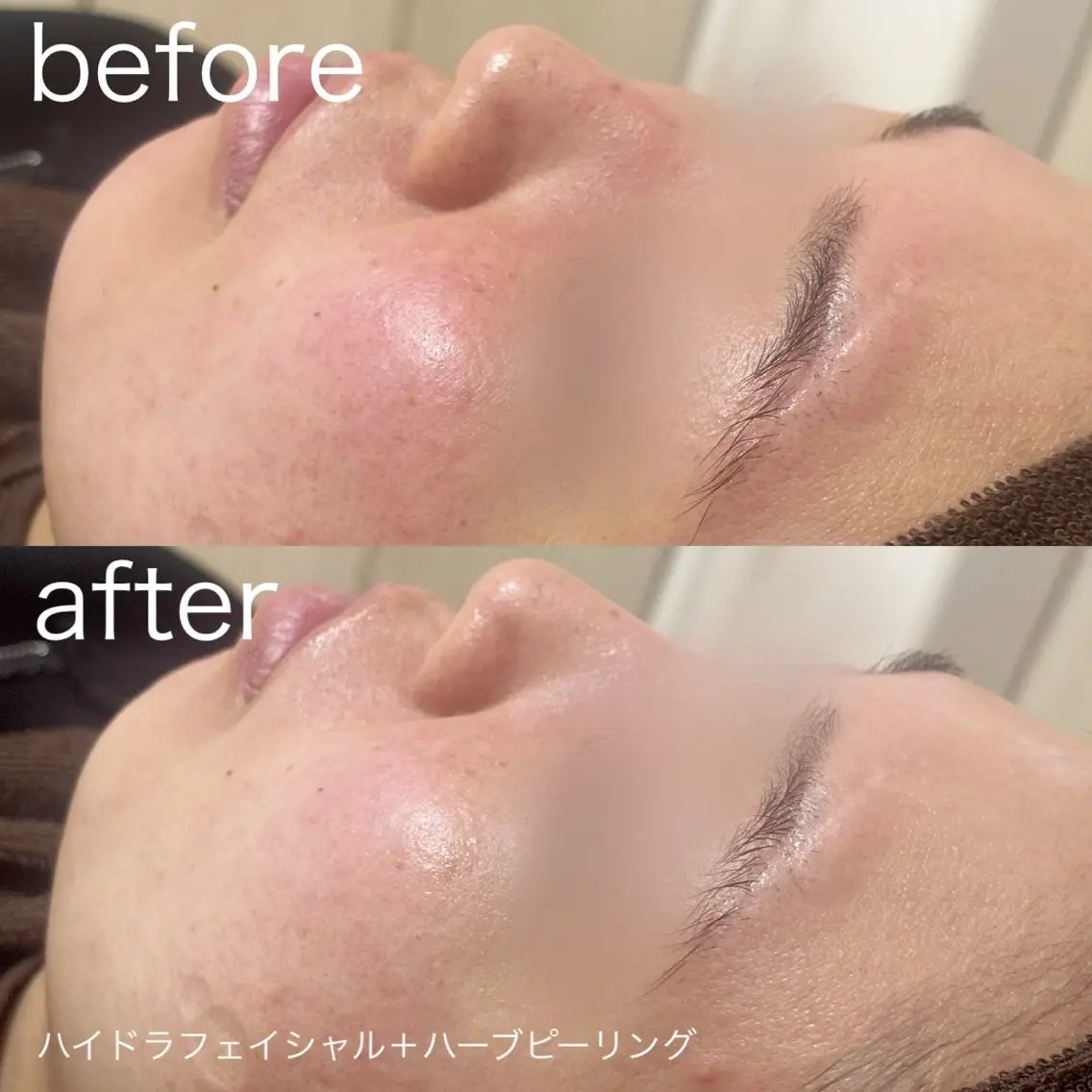 その他 lulularico Yuのネイルデザイン