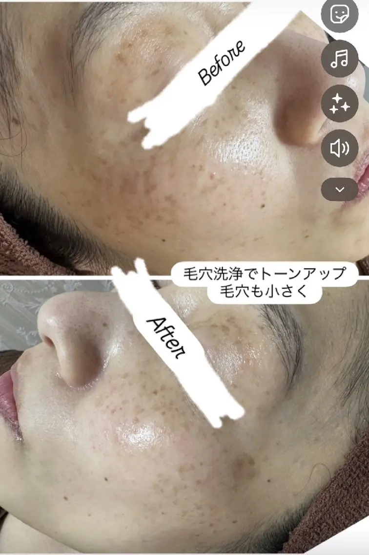その他 看護師 桐山 まどかのエステ・リラクイメージ