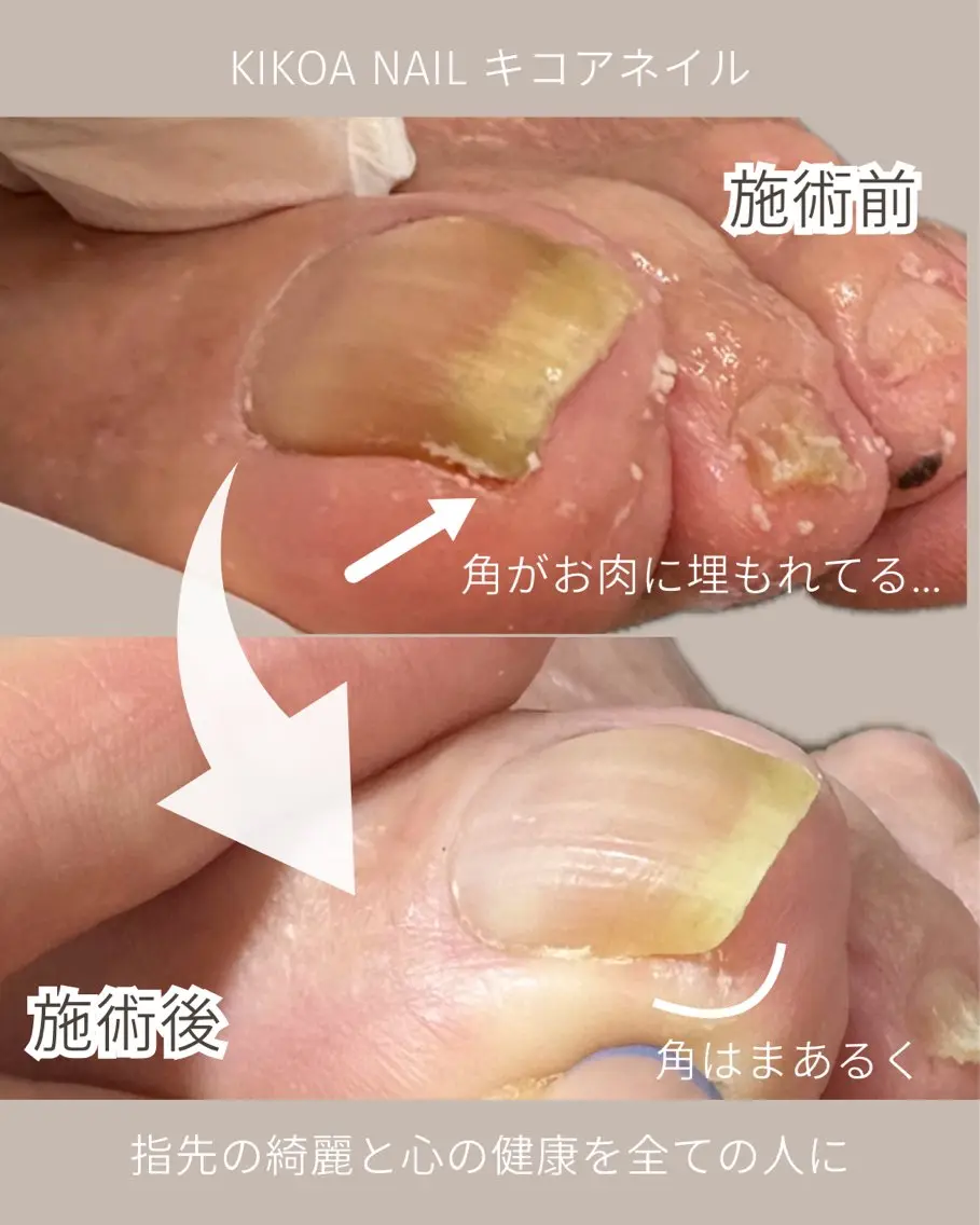 ネイル KIKOA NAIL キコアネイルのネイルデザイン