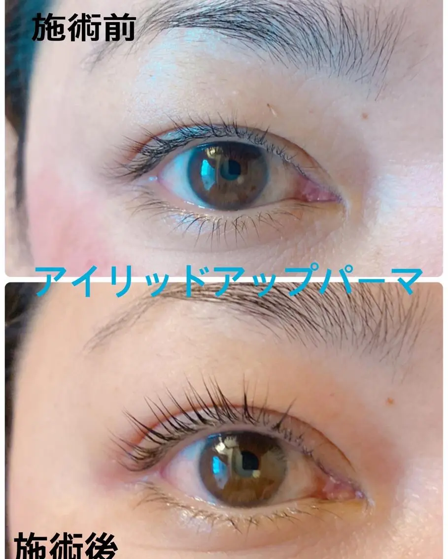 アイリッドアップパーマの写真