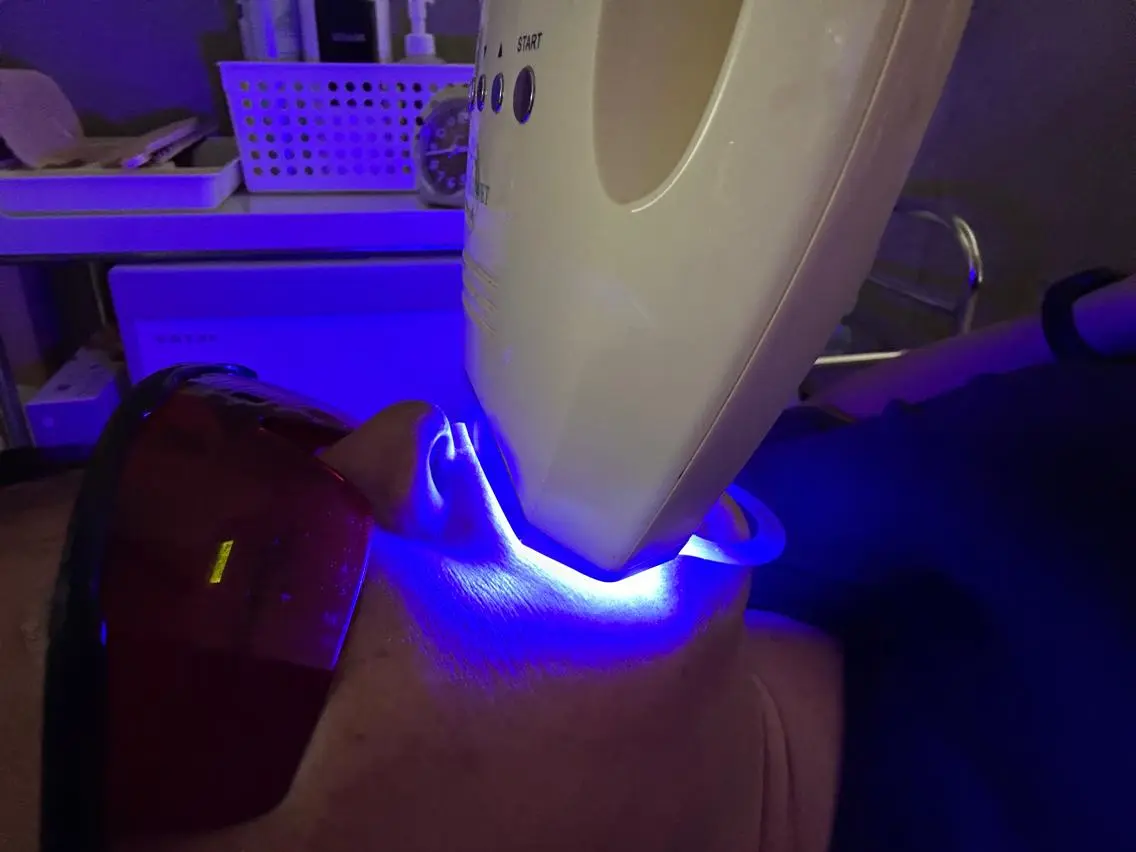その他 ホワイトニングジム 池袋のその他イメージ