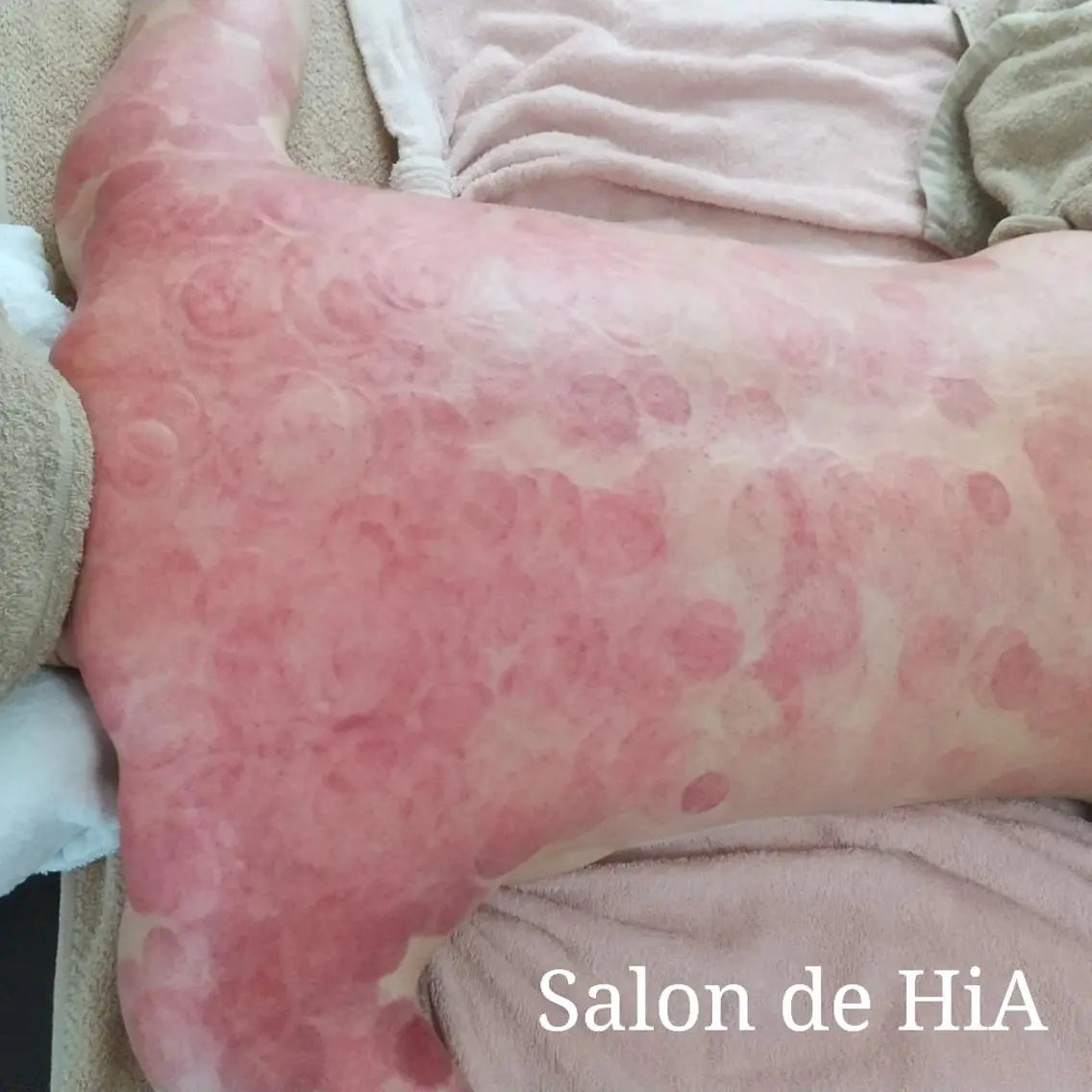 エステ リラク Salon de  HiAのエステ・リラクイメージ