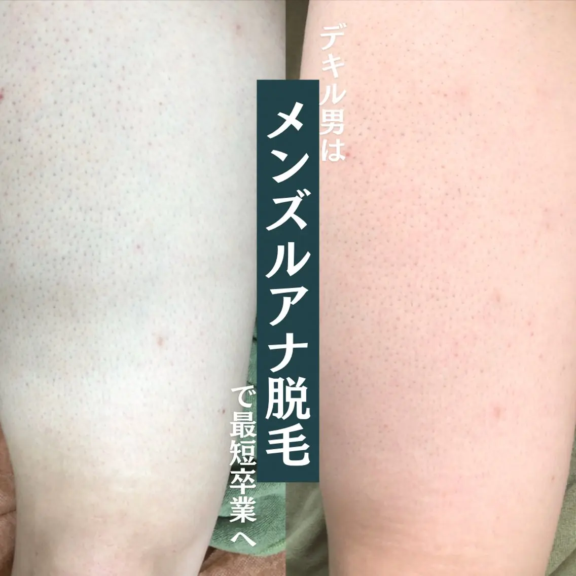 ルアナアイナ 大分のエステ・リラクイメージ