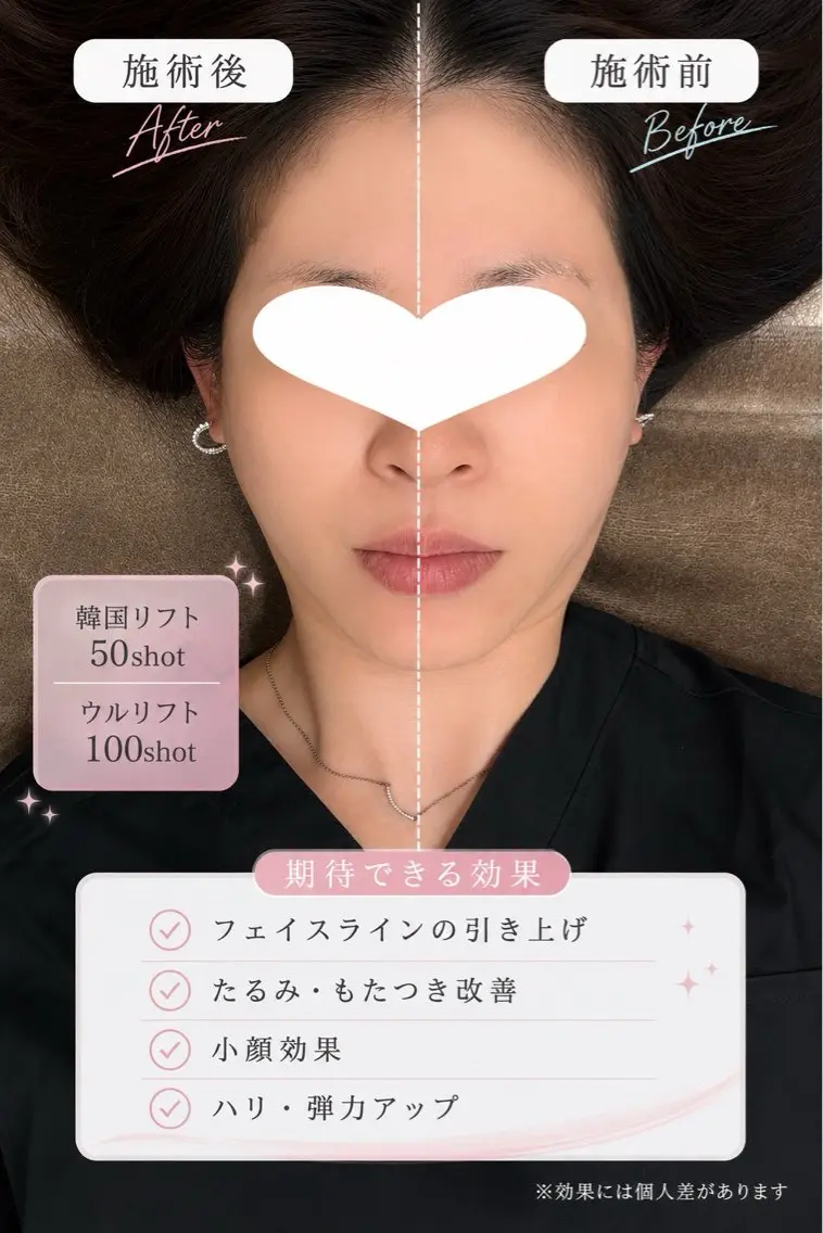マツエク・マツパ エステ 愛維美水光美肌専門店 メンズレディースokのエステ・リラクイメージ