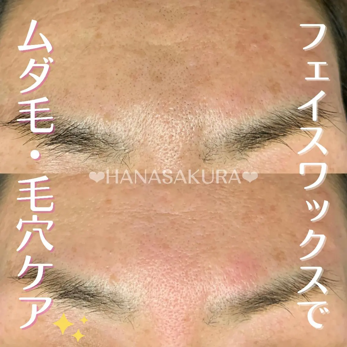 脱毛 HANASAKURA 心斎橋のエステ・リラクイメージ
