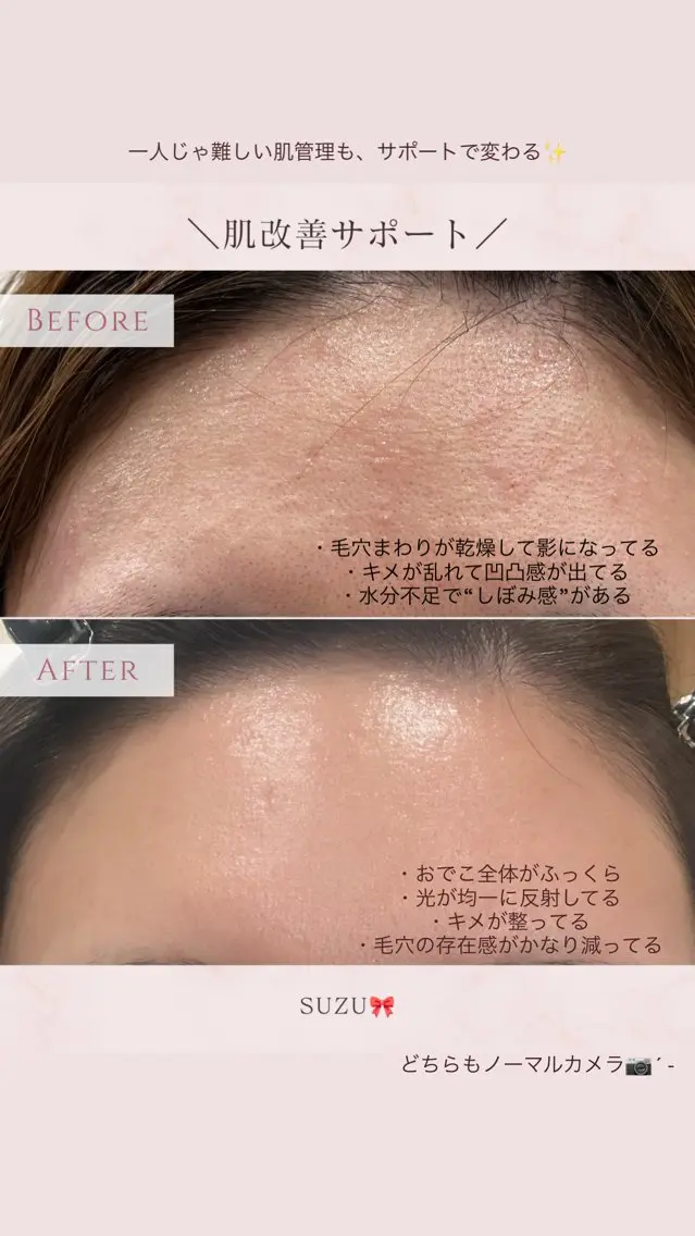 その他 肌改善サポート suzu🎀の眉毛・アイブロウイメージ