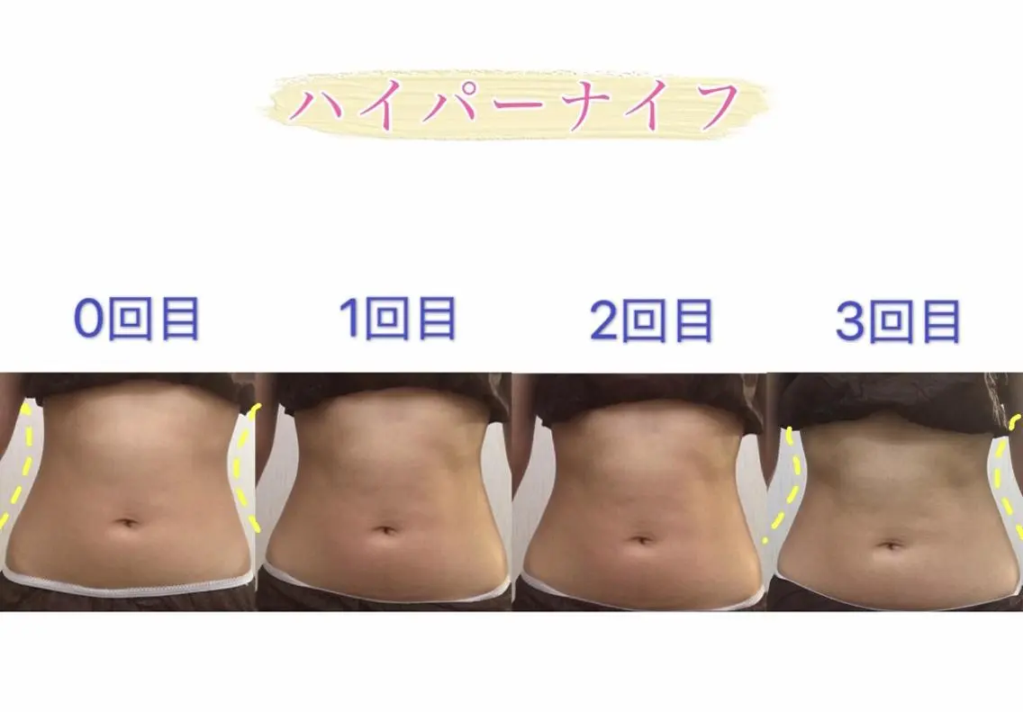 OPREA 栄店のエステ・リラクイメージ