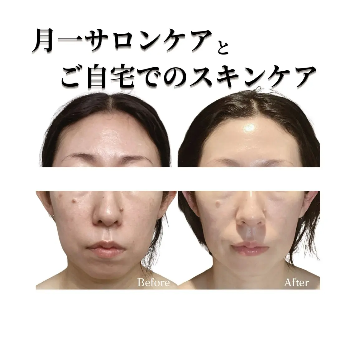 看護師 AYUIのエステ・リラクイメージ
