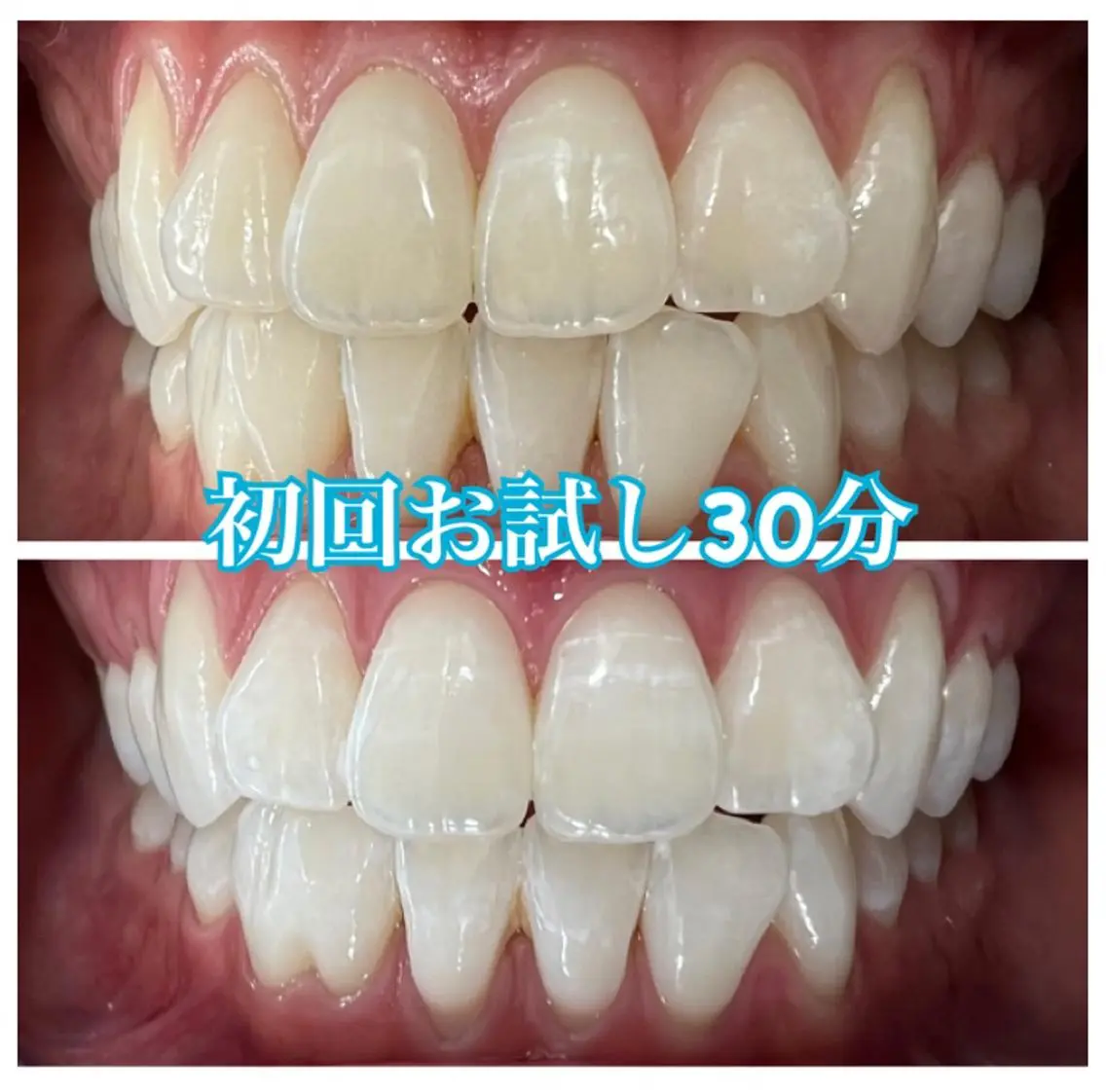 ホワイトニング🦷 ネイル💅LEAのその他イメージ