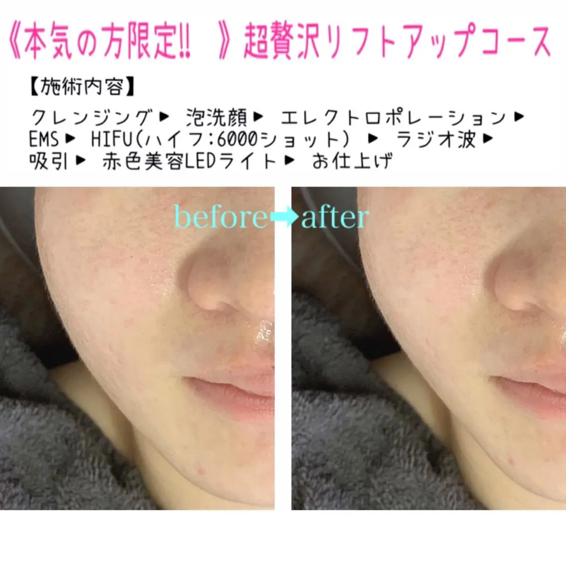 エステ HANA MIKIの眉毛・アイブロウイメージ