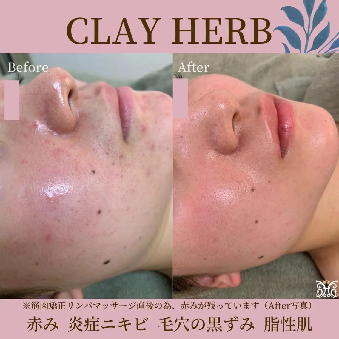 エステ リラク cerisier BEAUTÉのエステ・リラクイメージ