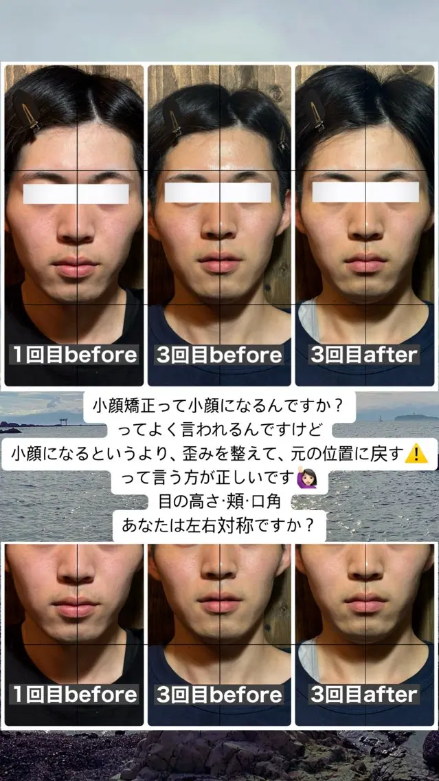 エステ リラク 💎後悔させない小顔 矯正💎イトヤマ🌱のエステ・リラクイメージ