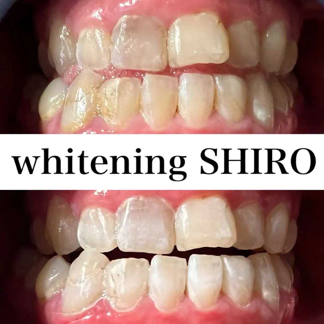 福岡ホワイトニング SHIRO天神店のエステ・リラクイメージ